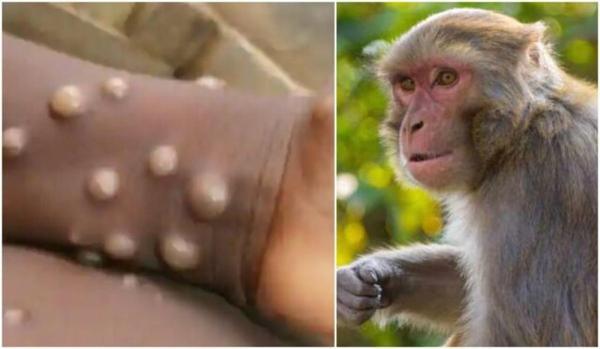مقدار اثرگذاری واکسن آبله بر آبله میمونی